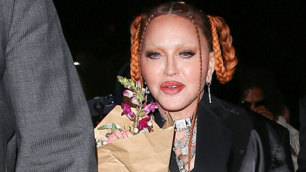 Tehohoitoon joutuneen Madonnan, 64, terveydentila huolestuttaa: hallitsematonta oksentelua ja kuukauden kestänyt kuume