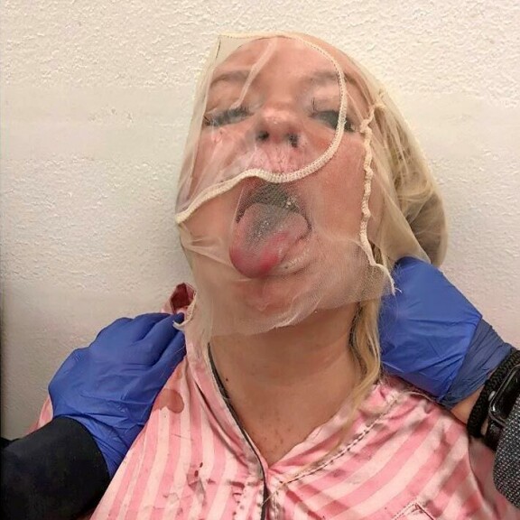 Sylkyhuppuun puettu Johanna oli ilmeisesti pidätysiltana nauttinut punaviiniä. Kuva on Ruotsin poliisin esitutkintapöytäkirjasta. Sylkyhuppuun puettu Johanna oli ilmeisesti pidätysiltana nauttinut punaviiniä. Kuva on Ruotsin poliisin esitutkintapöytäkirjasta.