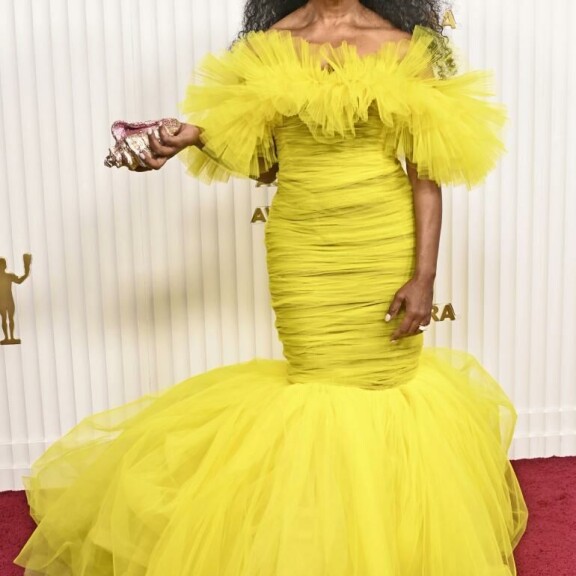 Heidi Klum on kuin kaljuuntuva kanarialintu – julkkisten keltaiset kevättyylit Seiskan muotipoliisin ratsiassa Angela Bassett