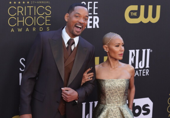 Jada Pinkett Smith sairastaa alopeciaa, joka johtaa hiustenlähtöön.