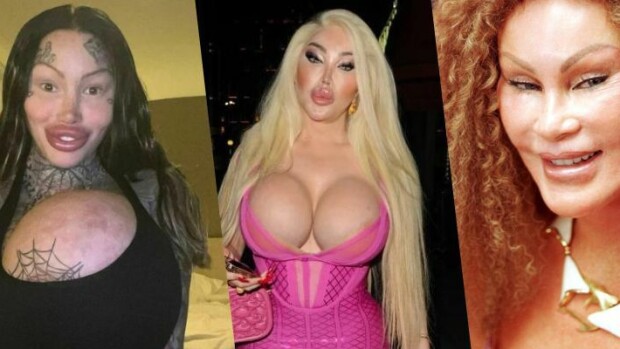 Kattava lista! Muistatko nämä dramaattiset kauneusleikkaukset? Jocelyn Wildenstein, Madonna, Linda Evangelista...