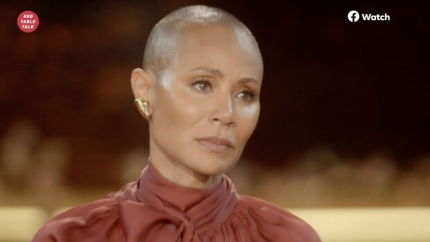 Tällainen on Jada Pinkett Smithin ja monen muunkin julkkiksen vaiva alopecia