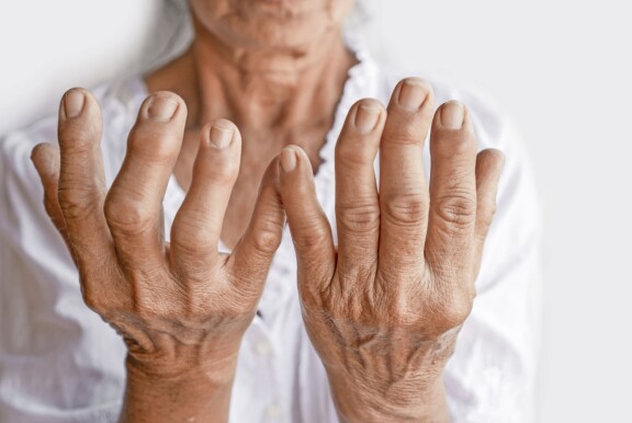 Terveysuutiset: Löhöily lisää dementiariskiä