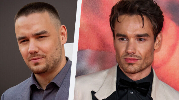 Fanit järkyttyivät! Mitä ihmettä tapahtui laulaja Liam Paynelle? - 'Hänen kasvonsa ovat riutuneet' Liam Payne