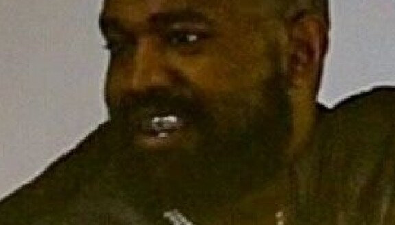 Ai kamala! Kanye vaihtoi hampaansa suoraan titaanilevyyn - kuvat!