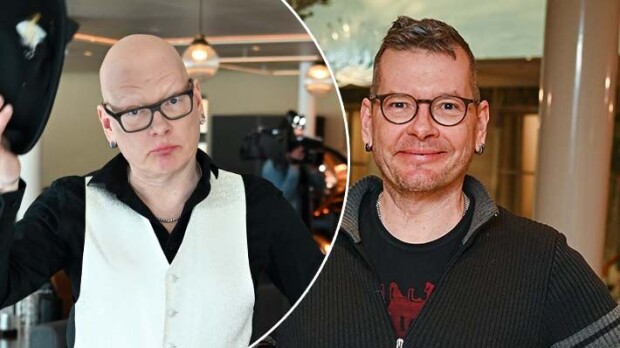 Kaikki kehon karvat lähtivät! Sami Garam avoimena sairaudestaan