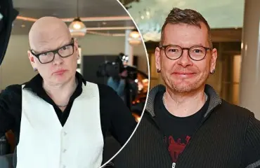 Kaikki kehon karvat lähtivät! Sami Garam avoimena sairaudestaan