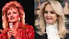 Bonnie Tyler, 72, Seiskalle: Laitoin botox-piikit tauolle! - Jyrähtää nuorten naisten huulitäytteistä