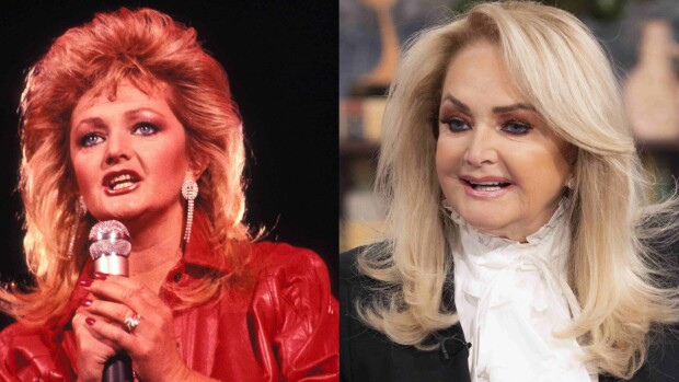 Bonnie Tyler, 72, Seiskalle: Laitoin botox-piikit tauolle! - Jyrähtää nuorten naisten huulitäytteistä