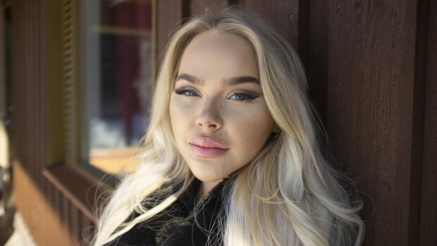 Onlyfans-sisällöntuottaja kertoo rajusti epäonnistuneesta kauneusleikkauksestaan tv:ssä: 'Onneksi selvisin hengissä'
