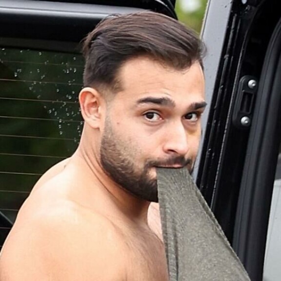 Silmän alla on selkeästi nähtävissä tumma jälki. Silmän alla on selkeästi nähtävissä tumma jälki.