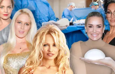 Bye bye daisarit! Nämä julkkikset ovat poistattaneet rintaimplanttinsa