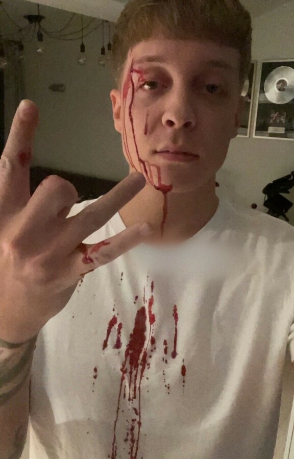 William vuoti verta, kun hänen silloinen avovaimonsa Sonja Aiello iski kännykällä otsaan.