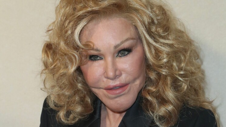 Kissanainen Jocelyn Wildenstein, 82, ja nuori sulho deiteillä – jakavat kiinnostuksen kauneuskirurgiaa kohtaan