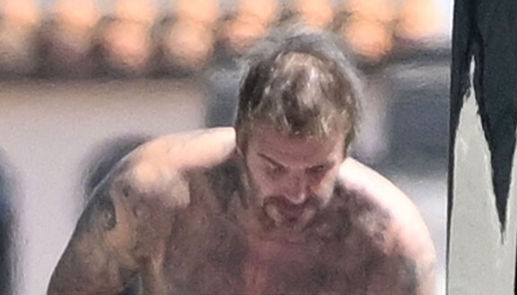 Nähtäväksi jää, aikooko hiuksistaan tarkka David Beckham tehdä asialle jotain.