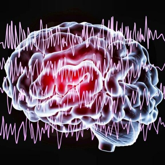 Terveysuutiset: 2-tyypin diabetes lisääntyy – tässä syy Epilepsia