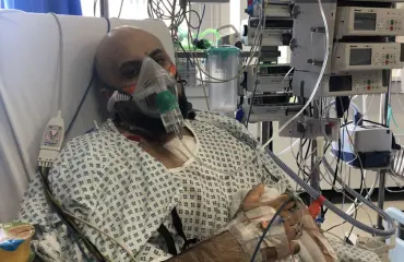 Luuli närästykseksi – jättimäinen sydänleikkaus pelasti liikemiehen hengen