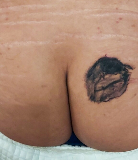 Karmea tatuointi sijaitsee oikean pakaran yläosassa.