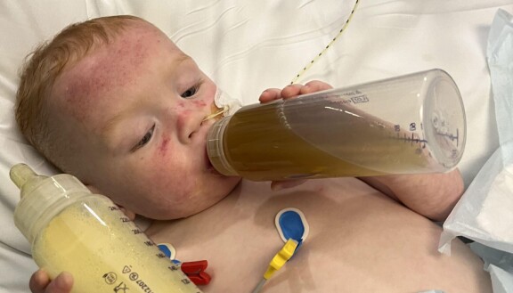 Teddy oli vain 1,5 vuotta vanha, kun hänelle diagnosioitiin leukemia.