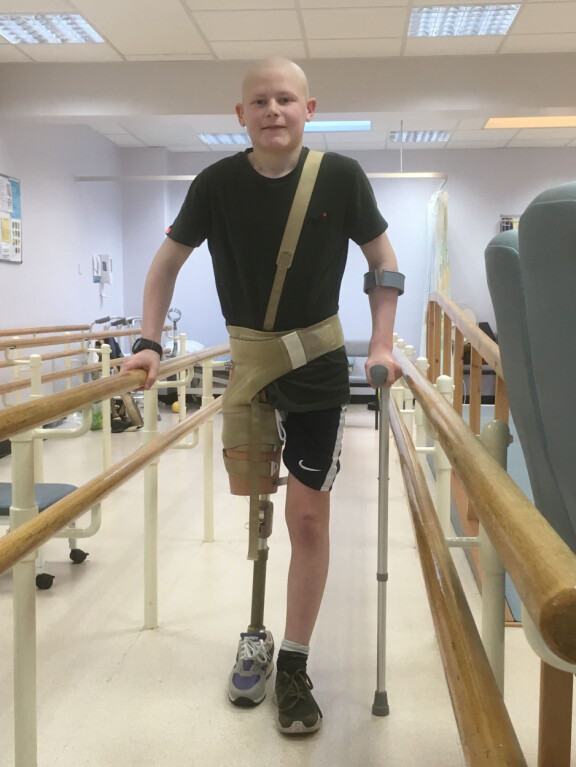 Oliverin oikea jalka amputoitiin, kun poika oli 13-vuotias.