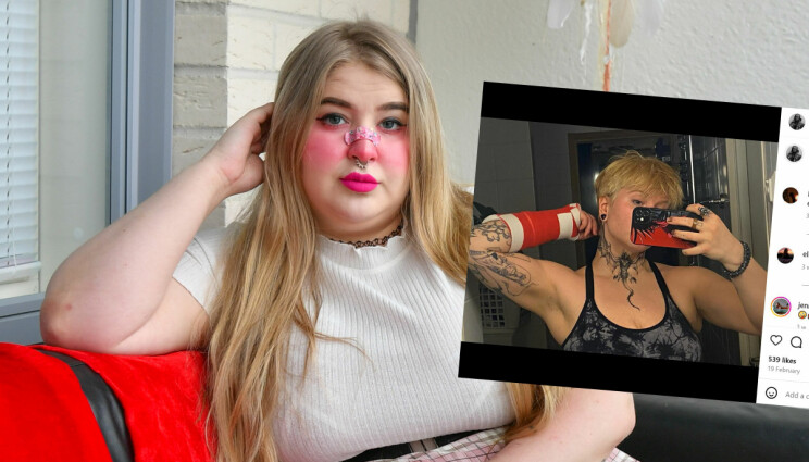 Hurjan muodonmuutoksen kokenut TIS-Anna murjoi kätensä - kuvat!
