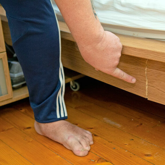 Henryn paino on jatkanut selittämätöntä nousuaan. Haastattelun aamuna hän oli noussut sängyllään istumaan, jolloin sänky petti alta. Henryn paino on jatkanut selittämätöntä nousuaan. Haastattelun aamuna hän oli noussut sängyllään istumaan, jolloin sänky petti alta.