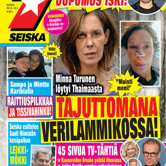 Takavuosien suosikkinäyttelijä Minna Turunen löytyi Thaimaasta tajuttomana verilammikossa – sokeeraavat kuvat Seiskassa! Minna Turunen Seiskan kannessa.