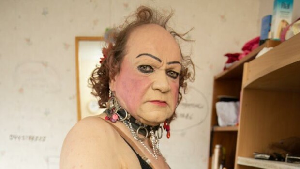 Paljastava kuva! Romutransu Markus Kuotesaho avautuu inhottavasta sairaudestaan: ”Näyttää kuin olisi kuukautiset!” Markus Kuotesaho