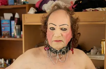 Romutransu Markus Kuotesaho kokeili valohoitoa sairauteensa – ”Tuli entistä pahempana takaisin!” 