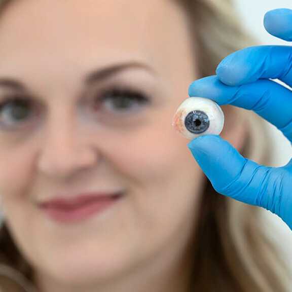 Lauralle silmäproteesien valmistus on intohimo. Laura Routa tekosilmä