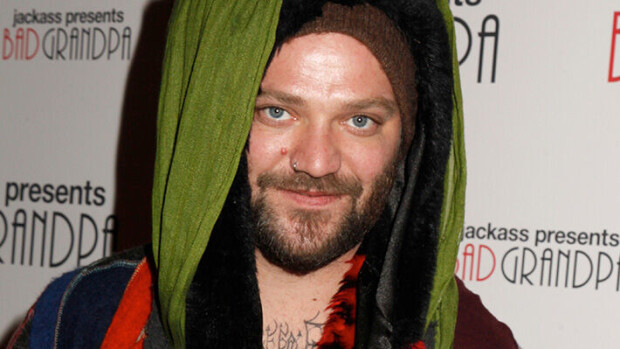 Bam Margera vakavasti sairas - kamppailee hengityskoneessa teho-osastolla Bam Margera