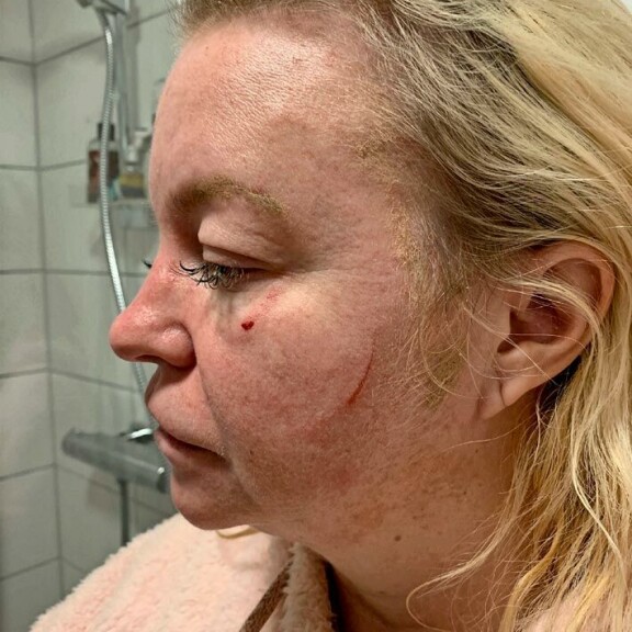 Tuomion mukaan Veijo oli lyönyt ja raapinut Johannaa. Tuomion mukaan Veijo oli lyönyt ja raapinut Johannaa.