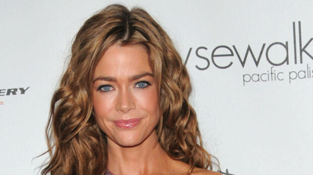 Kuva järkytti! Näyttelijä Denise Richards silmä mustana – tästä on kyse