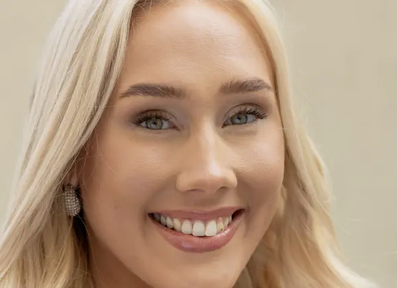 Uusi Miss Suomi avautuu tilanteestaan