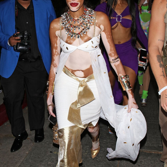 Hollywood villiintyi halloweenista! Jennifer Garner puki koiransakin haamuksi - katso starojen hurjat naamiaisasut Winnie Harlow