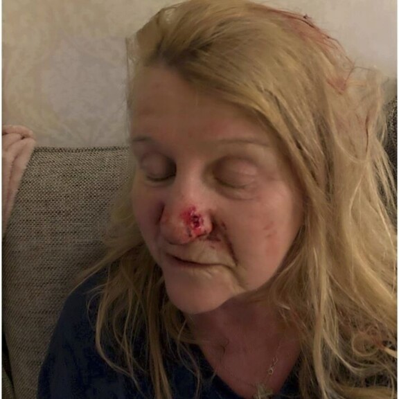Johanna raapi äitinsä nenän verille. Marja Tukiainen