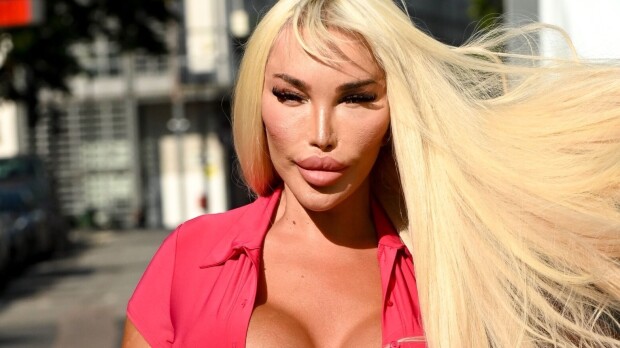 Mitä ihmettä tapahtui ihmis-Barbie Jessica Alvesille?