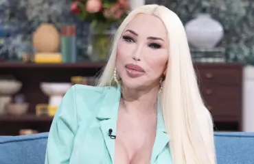 Jestas! Jessica Alves kävi kuudennessa kasvojenkohotuksessa – kuvat!