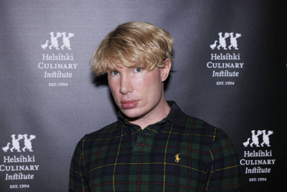 Tältä Joni näytti ennen uusinta leikkausrumbaansa.