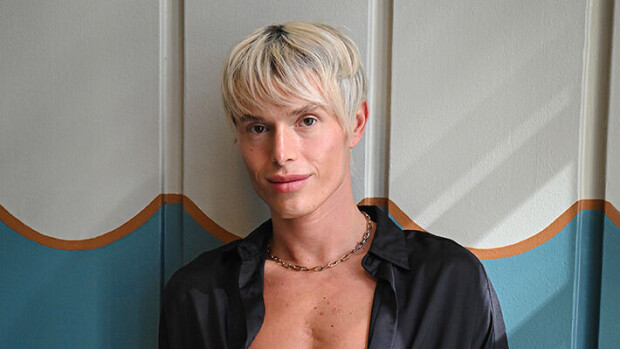 Marko Björsin rakkaudesta kilvoitellut Sergey Hilman on törsännyt jo 20 000 euroa plastiikkakirurgiaan - säntää taas veitsen alle: 'Makaan altaalla pää paketissa' Sergey Hilman