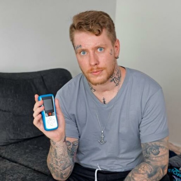 Tomas lääkitsi oireitaan pitkään alkoholilla, mutta uskalsi lopulta ottaa DBS-laitteen. – Elämä on mennyt sen jälkeen paljon parempaan suuntaan. Lepotärinää ei ole enää juuri ollenkaan. Tomas Jouhilampi