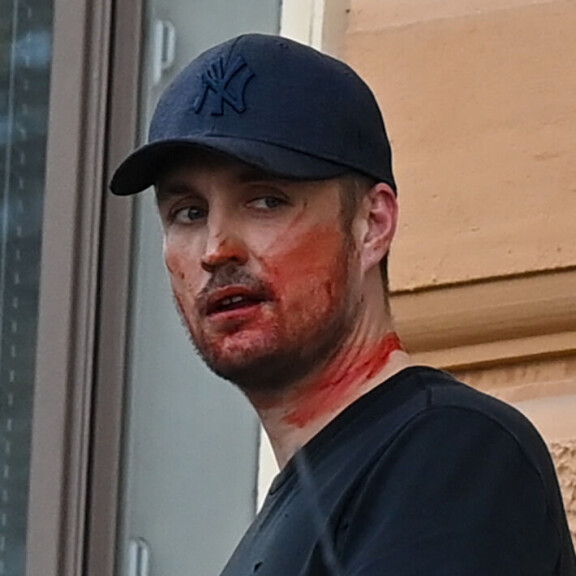 Stefu yritti muina miehinä luikkia pois tapahtumapaikalta. Verinen naama herätti poliisien huomion. Stefan Therman