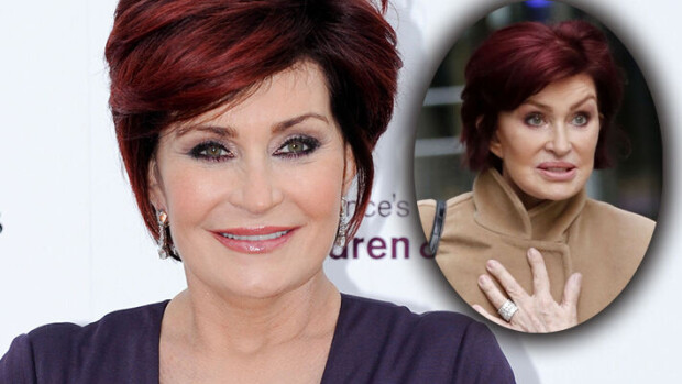 Sharon Osbourne tilittää pieleen menneestä kauneusleikkauksesta: 'Näytin ihan kykloopilta' - tältä hän näyttää nykyään Sharon Osbourne