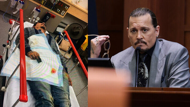 Kuvat ei herkille! Raju väite: Amber Heard raivostui Johnny Deppille avioehdosta – mukiloi näyttelijän sairaalakuntoon Johnny Depp