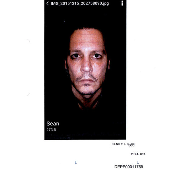 Oikeudessa esitetyn todisteen mukaan Amber oli aiheuttanut Deppin vasempaan otsaan ruhjeen. Johnny Depp