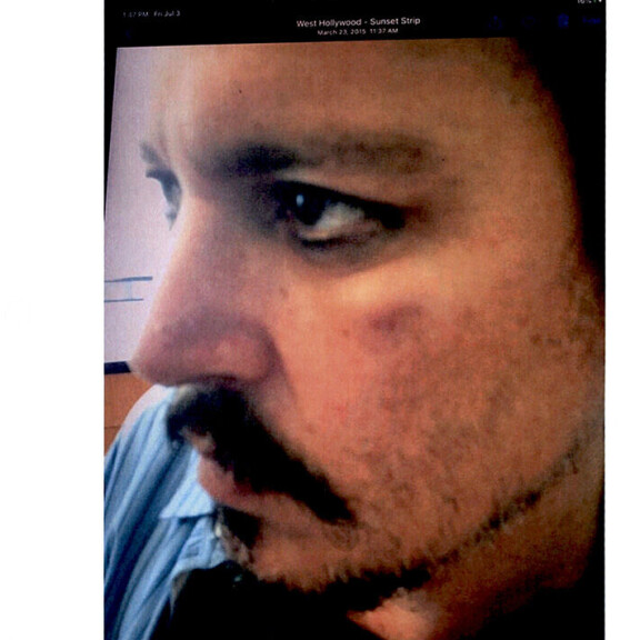 Depp kertoi Amberin polttaneen hänen kasvojaan tupakalla. Johnny Depp