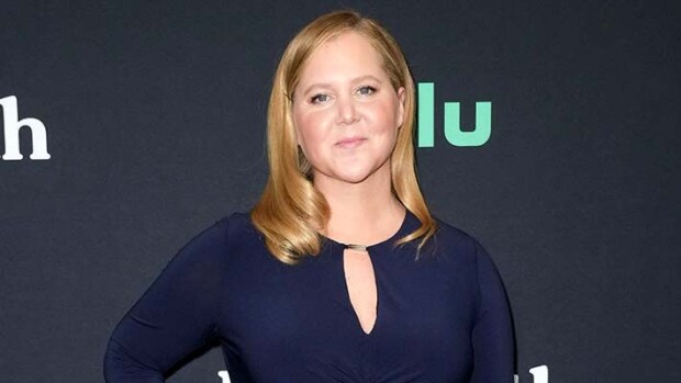 Amy Shumer paljasti sairastaneensa erikoista tautia teinistä asti: repii väkisin hiuksia! amy schumer