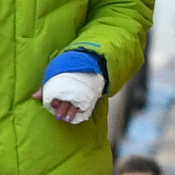 Huhhuh! Mitä ihmettä tapahtui Petrus Pennasen kädelle – katso uudet paparazzikuvat kohuparista! Petrus Pennanen