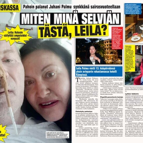 SEISKA 30/2017 Juhani joutui; tulipalo-onnettomuuteen myös vajaa neljä vuotta sitten. Tuolloin Juhani istui tuolissa lukemassa lehteä, joka syttyi kynttilästä liekkeihin. SEISKA 30/2017 Juhani joutui tulipalo-onnettomuuteen myös vajaa neljä vuotta sitten. Tuolloin Juhani istui tuolissa lukemassa lehteä, joka syttyi kynttilästä liekkeihin.