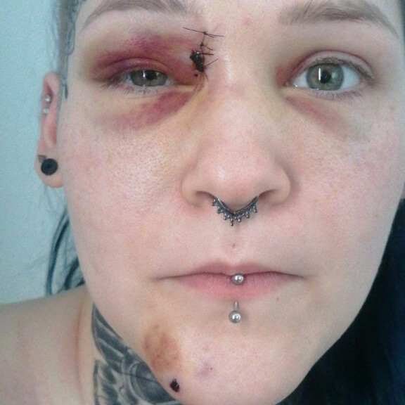 Julia vaatii häntä kasvoihin ampuneelta pojalta korvauksia. - Keskustelemme asianajajani kanssa, kun tapaus etenee syyttäjälle. TIS-Julia
